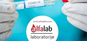 alfalab-laboratorija-web-sajt-itd-marketing-kuponpopust